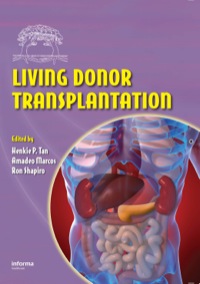 Cover image: Living Donor Transplantation 1st edition 9780849337666