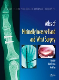 Titelbild: Atlas of Minimally Invasive Hand and Wrist Surgery 1st edition 9780849370144