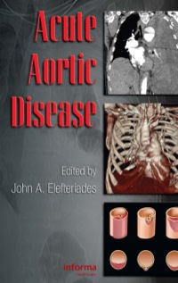 صورة الغلاف: Acute Aortic Disease 1st edition 9780849370236