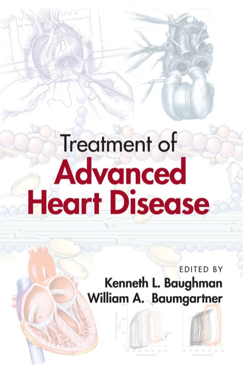 Treatment of Advanced Heart Disease, 1st Edition - FULL INSTANT DOWNLOAD | PDF DOCX EPUB