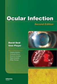 صورة الغلاف: Ocular Infection 2nd edition 9780849390937