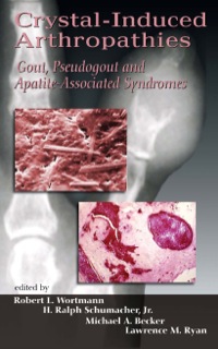 Cover image: Crystal-Induced Arthropathies 1st edition 9780849393822