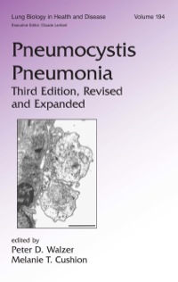 صورة الغلاف: Pneumocystis Pneumonia 3rd edition 9780824754518