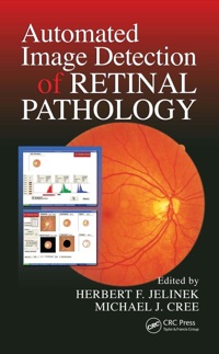 Cover image: Automated Image Detection of Retinal Pathology 1st edition 9781138114494