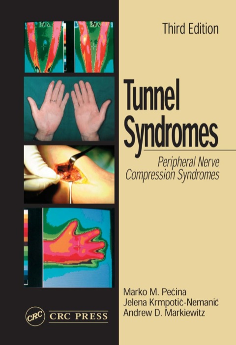 Tunnel Syndromes, 3rd Edition - FULL INSTANT DOWNLOAD | PDF DOCX EPUB