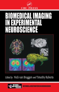 Cover image: Biomedical Imaging in Experimental Neuroscience 1st edition 9780849301223