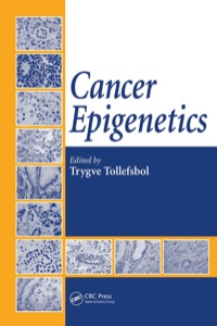Cover image: Cancer Epigenetics 1st edition 9780367386863