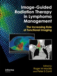 Imagen de portada: Image-Guided Radiation Therapy in Lymphoma Management 1st edition 9780367384487
