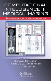 Imagen de portada: Computational Intelligence in Medical Imaging 1st edition 9781420060591