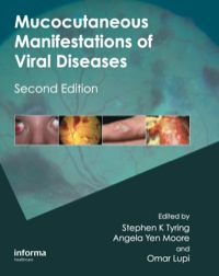 Immagine di copertina: Mucocutaneous Manifestations of Viral Diseases 2nd edition 9781420073126