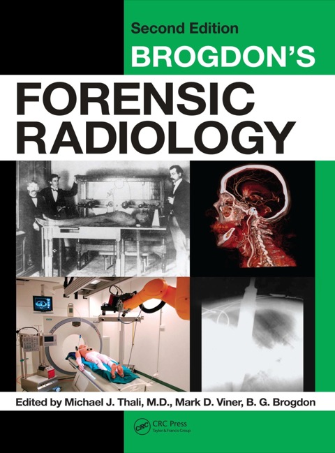 Brogdon's Forensic Radiology, 2nd Edition - FULL INSTANT DOWNLOAD | PDF DOCX EPUB