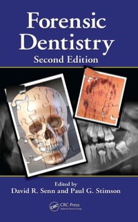 Imagen de portada: Forensic Dentistry 2nd edition 9781420078367