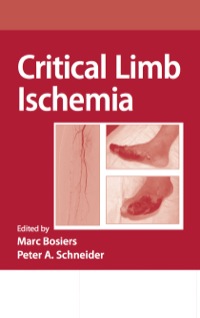 Cover image: Critical Limb Ischemia 1st edition 9781420081893