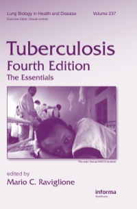 Cover image: Tuberculosis 4th edition 9781138117662