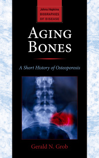 表紙画像: Aging Bones 9781421413181