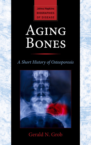 Cover image: Aging Bones 9781421413181
