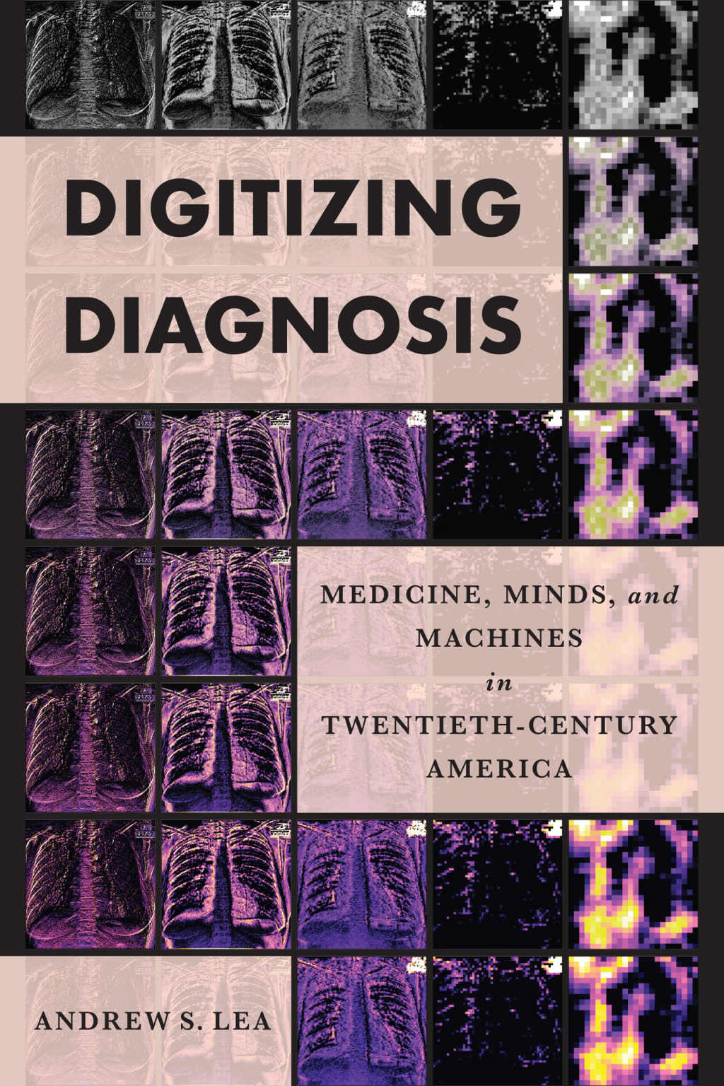 Digitizing Diagnosis Medicine, Minds, and Machines in Twentieth-Century America