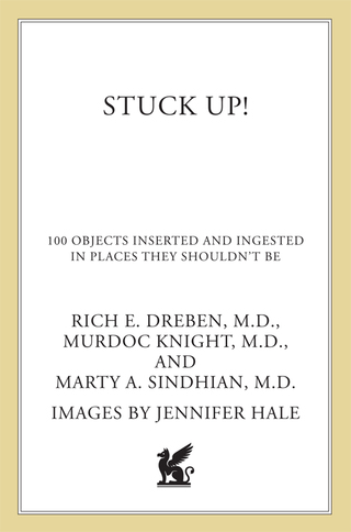 Cover image: Stuck Up! 9780312680084