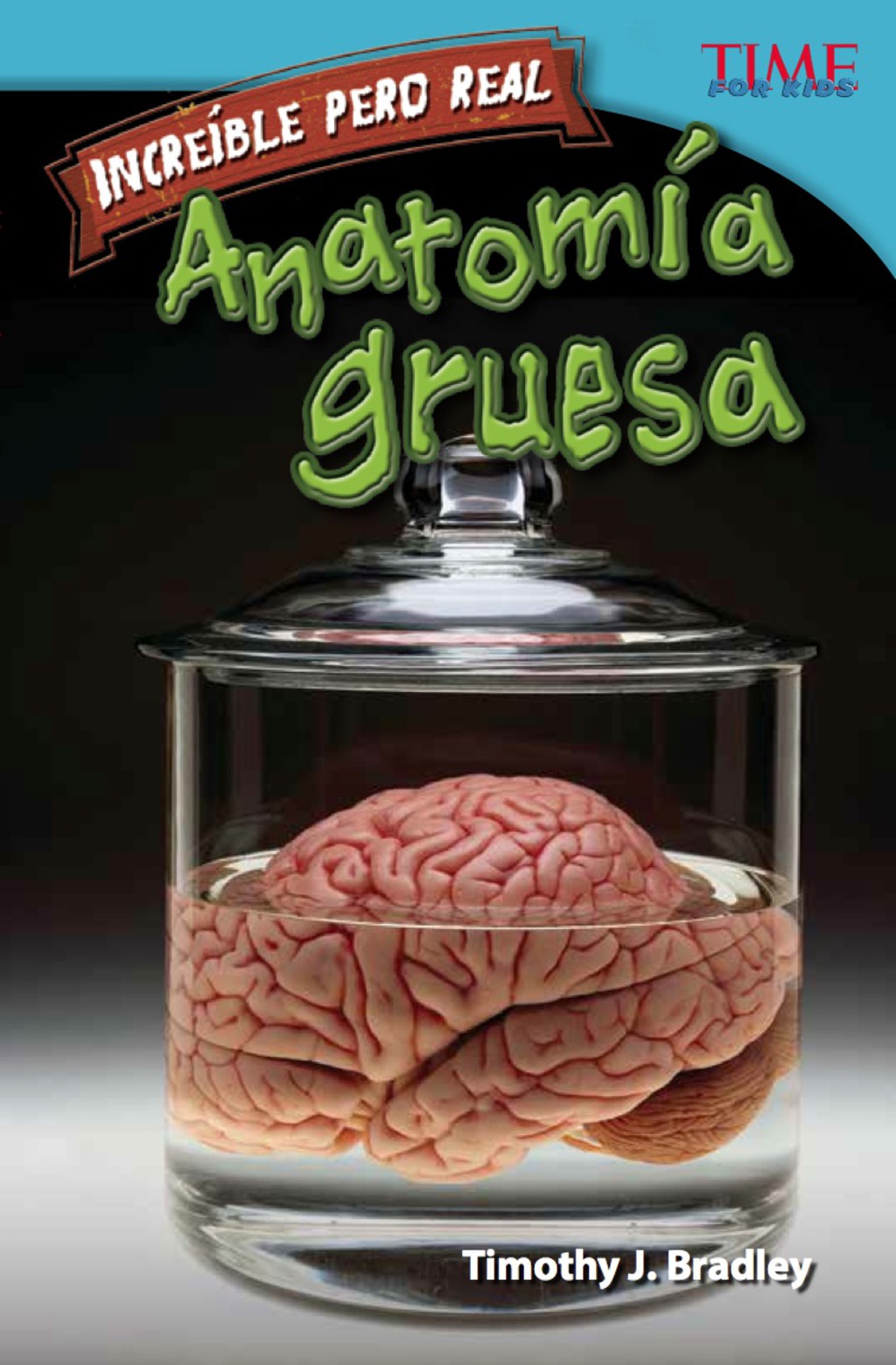 Increíble pero real: Anatomía gruesa (Strange but True: Gross Anatomy) 2nd Edition