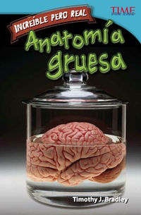 Cover image: Increíble pero real: Anatomía gruesa (Strange but True: Gross Anatomy) 2nd edition 9781433370939