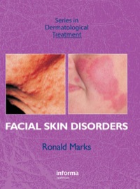 Omslagafbeelding: Facial Skin Disorders 1st edition 9781841842103