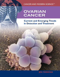 Cover image: Ovarian Cancer 9781435850064
