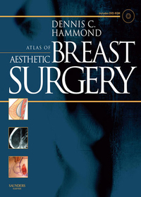 صورة الغلاف: Atlas of Aesthetic Breast Surgery 9781416031840