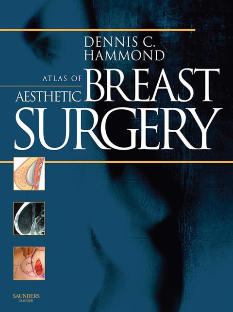 Atlas of Aesthetic Breast Surgery - FULL INSTANT DOWNLOAD | PDF DOCX EPUB