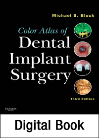 Cover image: Color Atlas of Dental Implant Surgery 3rd edition 9781437708776