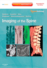 Cover image: Imaging of the Spine 9781437715514