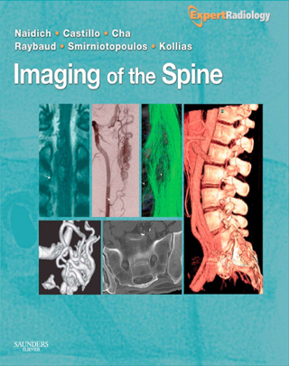 Cover image: Imaging of the Spine 1st edition 9781437715514