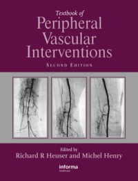 Titelbild: Textbook of Peripheral Vascular Interventions 2nd edition 9781841846439