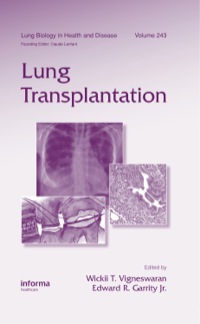 صورة الغلاف: Lung Transplantation 1st edition 9781439802557