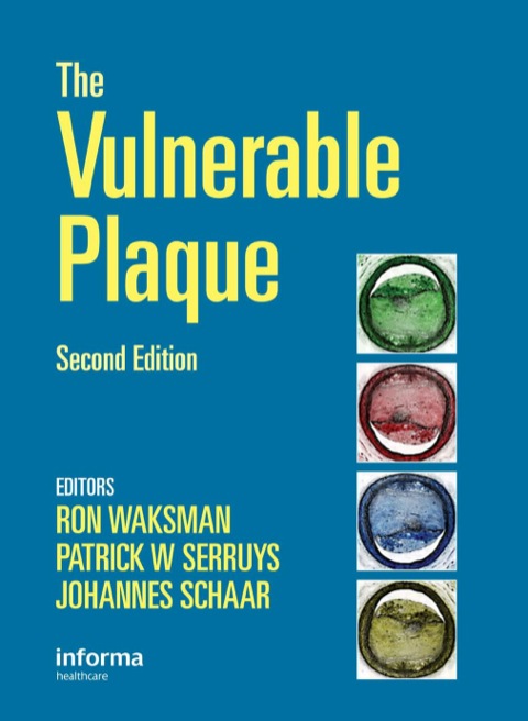 Handbook of the Vulnerable Plaque, 2nd Edition - FULL INSTANT DOWNLOAD | PDF DOCX EPUB