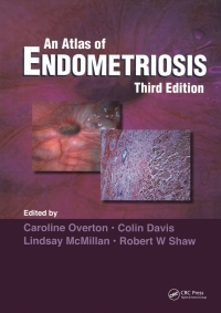 Cover image: Atlas of Endometriosis 3rd edition 9780415395731