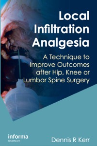 Omslagafbeelding: Local Infiltration Analgesia 1st edition 9781439811764