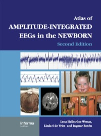 Immagine di copertina: An Atlas of Amplitude-Integrated EEGs in the Newborn 2nd edition 9781841846491