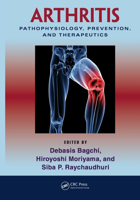 Arthritis : Pathophysiology, Prevention, and Therapeutics, 1st Edition - FULL INSTANT DOWNLOAD | PDF DOCX EPUB