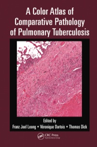 صورة الغلاف: A Color Atlas of Comparative Pathology of Pulmonary Tuberculosis 1st edition 9781138451995