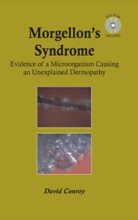 صورة الغلاف: Morgellon's Syndrome 1st edition 9781138416765