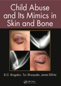 Cover image: Child Abuse and its Mimics in Skin and Bone 1st edition 9780367778187