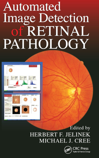 Cover image: Automated Image Detection of Retinal Pathology 1st edition 9781138114494