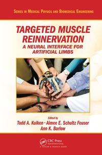 Cover image: Targeted Muscle Reinnervation 1st edition 9781439860809