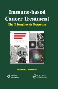 表紙画像: Immune-based Cancer Treatment 1st edition 9781578087037