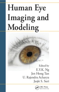 صورة الغلاف: Human Eye Imaging and Modeling 1st edition 9781138071650