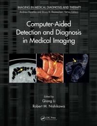 Omslagafbeelding: Computer-Aided Detection and Diagnosis in Medical Imaging 1st edition 9781439871768