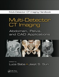 Cover image: Multi-Detector CT Imaging 1st edition 9781439893975