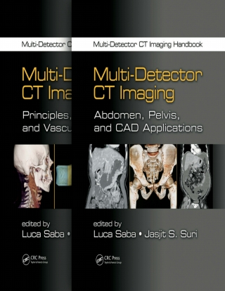 صورة الغلاف: Multi-Detector CT Imaging Handbook, Two Volume Set 1st edition 9781439893999