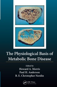 Imagen de portada: The Physiological Basis of Metabolic Bone Disease 1st edition 9781138198708