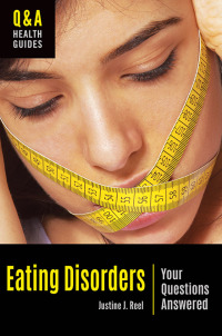 Imagen de portada: Eating Disorders 1st edition 9781440853043
